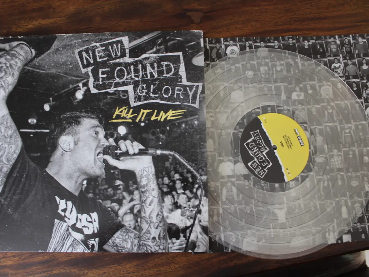 Chronic Low Back Pain linked to Degenerative Disc Disease treated with SB-01 (vicatertide) shows...