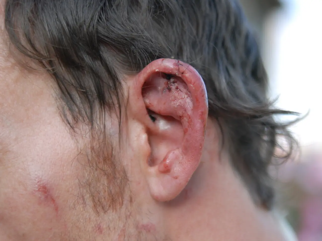 Hearing impairment caused by damage to the inner ear or nerve pathways to the brain:...