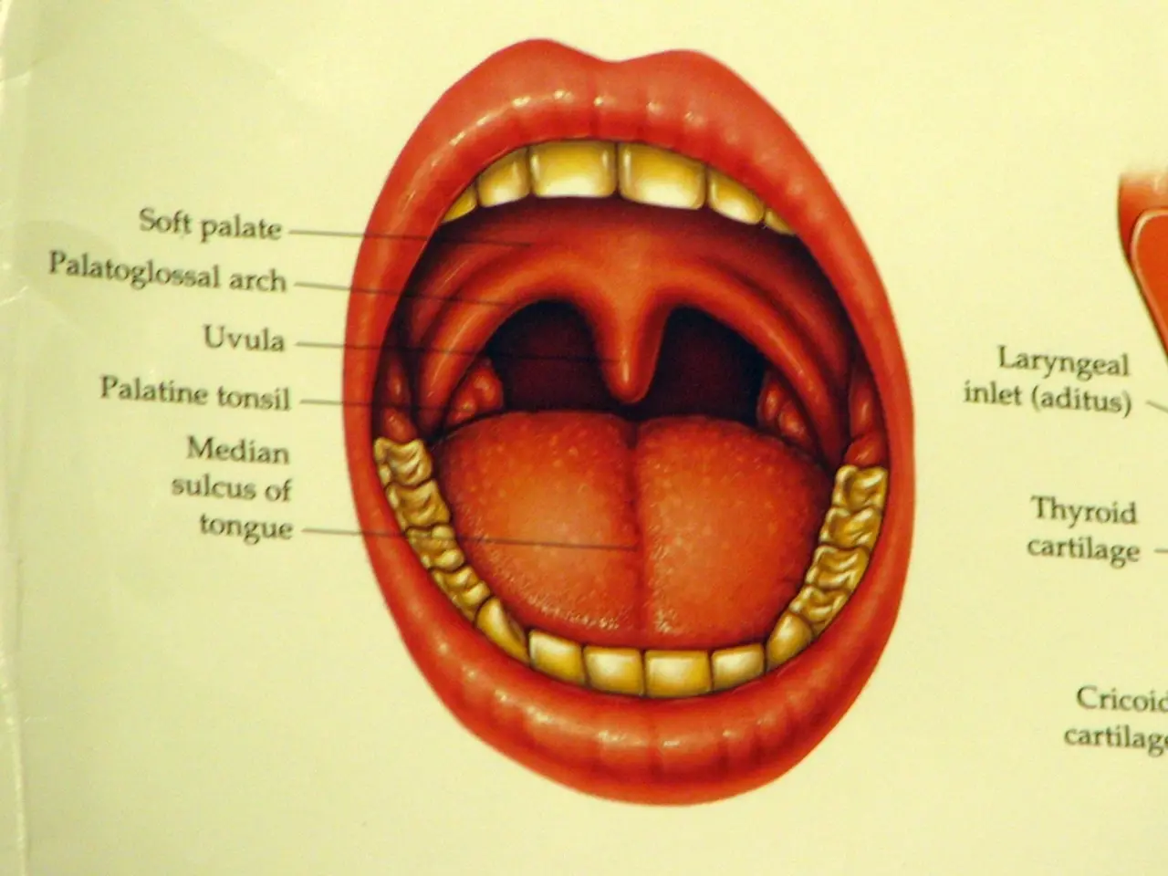 Images showing early-stage tongue cancer, specifically squamous cell carcinoma, in its first...