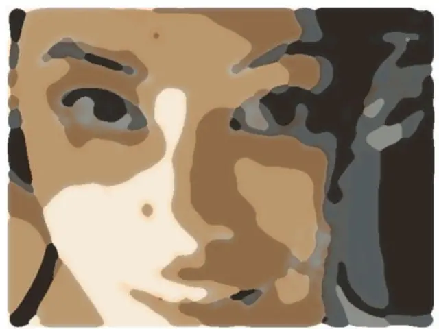 High-Intensity Focused Ultrasound Facial Explanation: Operations, Mechanism, Results, Pricing, and...