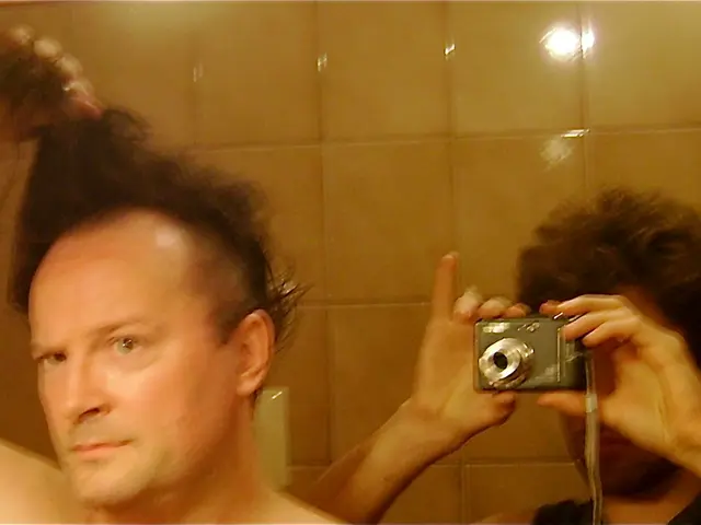 Essential Facts to Consider Before Undergoing a Hair Transplant Procedure