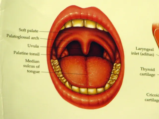 Images showing early-stage tongue cancer, specifically squamous cell carcinoma, in its first...