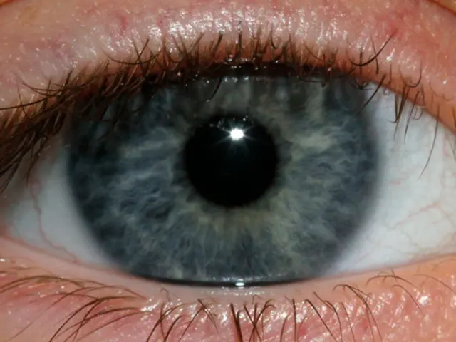 In this picture we can see a human eye. We can see iris, pupil and eyelashes.